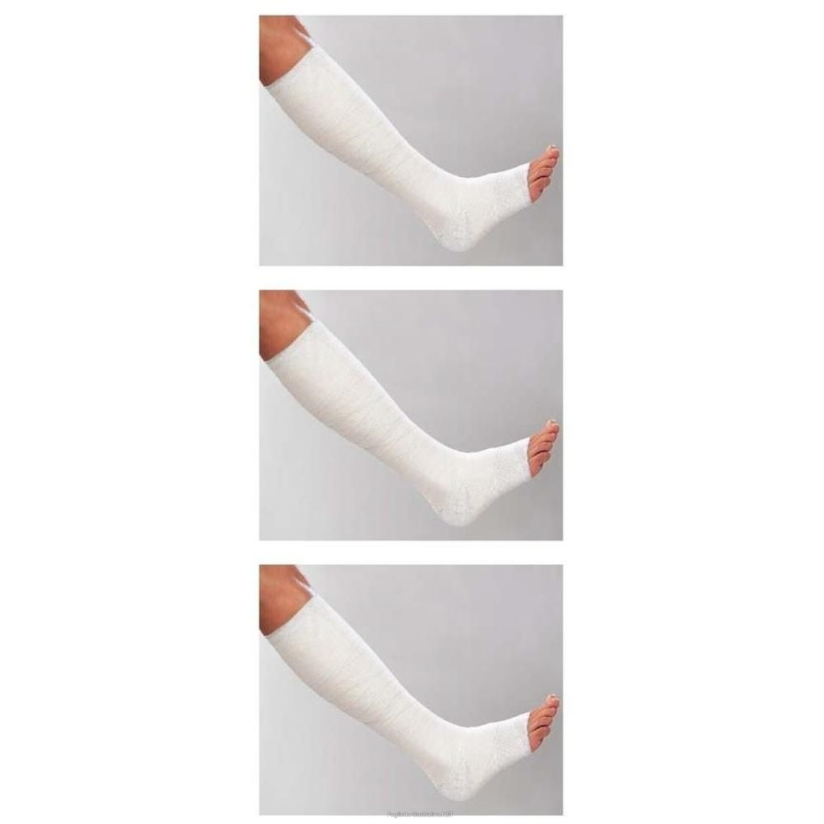 Trova Offerte di benda elastica medicata varicex s con ossido di zinco 10x500 cm 3x1 st e compra online