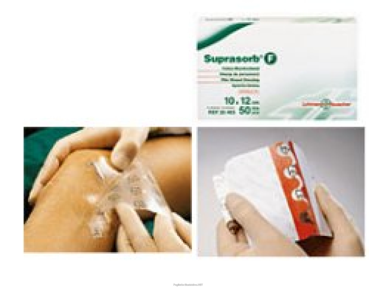Cerca Offerte di medicazione in film suprasorb f protect 10x12 cm 10 pezzi e acquista online
