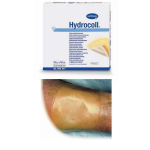 hydrocoll t medicazione 10x10 3 pezzi np bugiardino cod: 923374779 