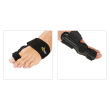 Ekeep h2 hallux valgus nott 02