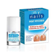 My nails post mycosis 5ml